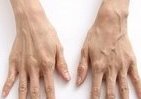 「この手、何歳に見える？」　老けて見られる「手肌年齢」に注意