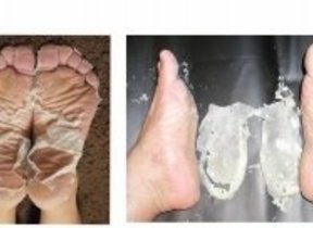 ベビーフットの記事一覧 J Castニュース