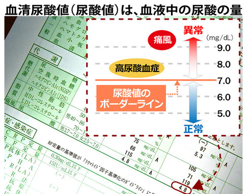 多くの健康診断には「尿酸」の値を示す項目が含まれている