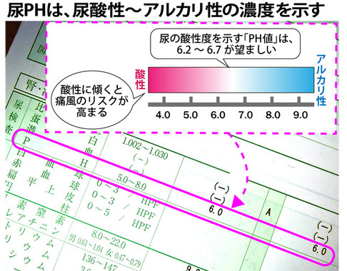 「尿PH」の値もチェックすべし。6.2～6.7が望ましい