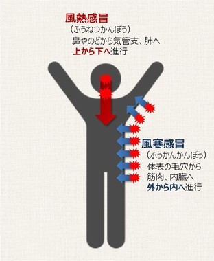 中国伝統医学からみた風邪は、「風熱感冒」と「風寒感冒」の2種類に大別される