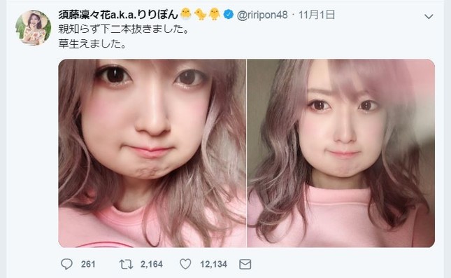 パンパンに頬が張れた須藤さん