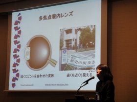 白内障治療について解説する東京歯科大学水道橋病院・ビッセン宮島弘子教授