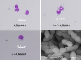 pDCに普通の乳酸菌、プラズマ乳酸菌を入れたときの反応。無添加（左上）、プラズマ乳酸菌（右上）、普通の乳酸菌（左下）。普通の乳酸菌では何も入れなかった場合と変化が無いが、プラズマ乳酸菌を入れるとpDCに角が生えて活性化しているのが分かる／右下は、電子顕微鏡で見たプラズマ乳酸菌