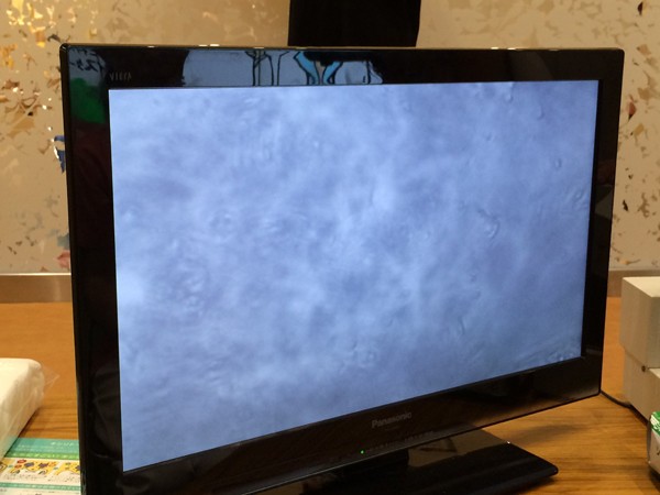 モニターに映し出された歯垢。大きさや形はさまざまで、なかには活発に動くものも