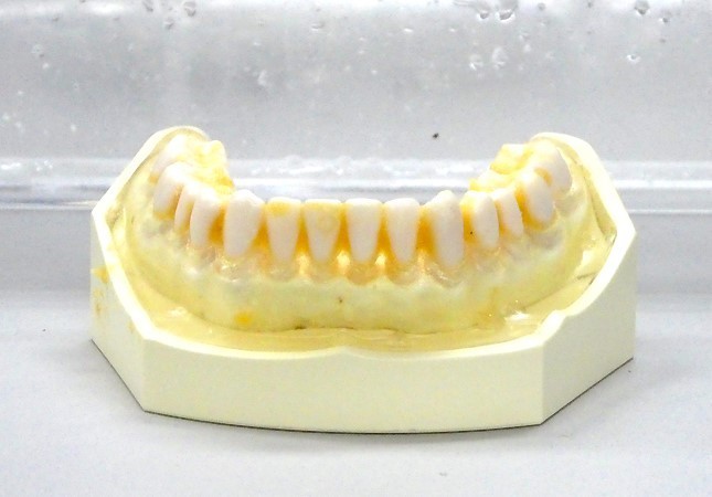 生キャラメルを付けた歯の模型をケースに入れて30秒間振った。汚れが残っている