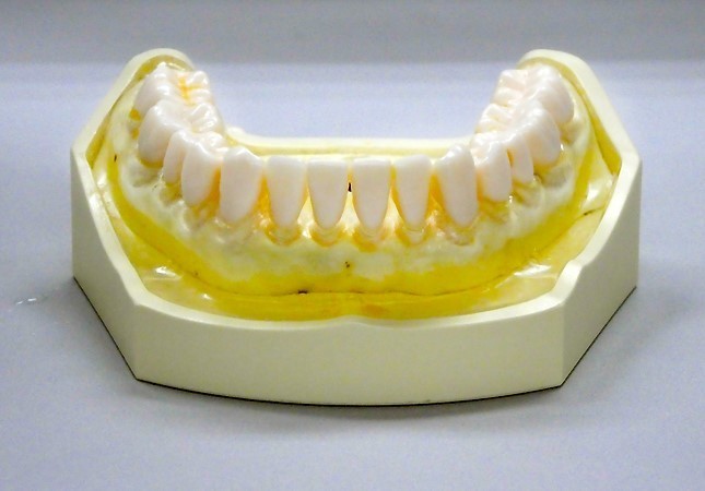 「ジェットウォッシャー ドルツ」で洗浄した歯の模型