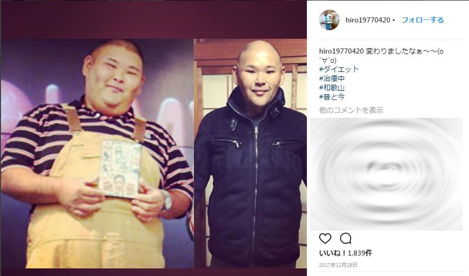 安田大サーカスHIROを襲った悲劇　ダイエット成功したのに手術なんて...