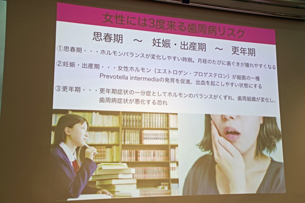 女性は思春期、妊娠・出産期、更年期に歯周病リスクが高まるという