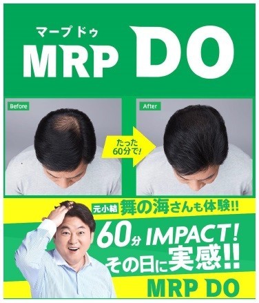 太めの髪でボリュームアップ　アートネイチャーの新増毛「MRP DO（マープドゥ）」