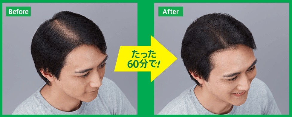 60分で増毛が実感できる「増毛60分5000円（税込）キャンペーン」