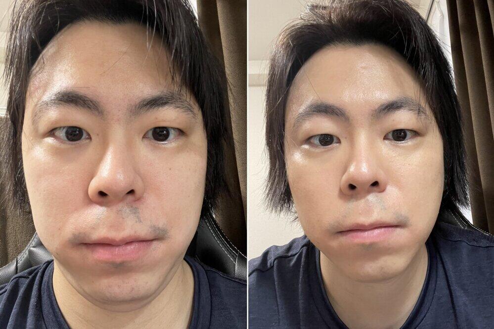 ビフォー（左）アフター（右）