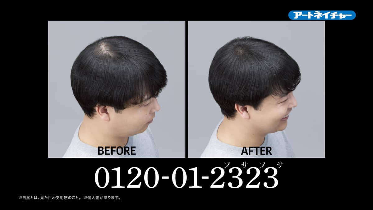 渋谷ジャパンさんの増毛前と後