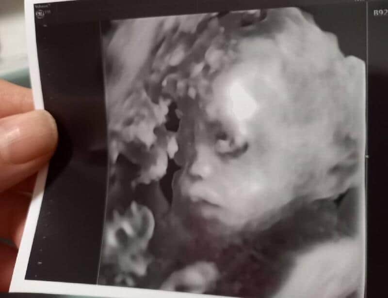 すっかり赤ちゃんの顔！