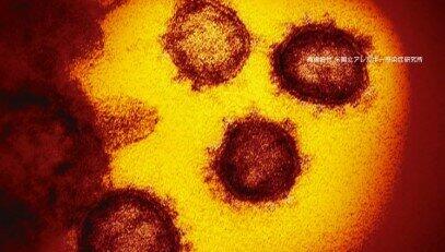 新型コロナウイルス（NHKの番組ホームページより）